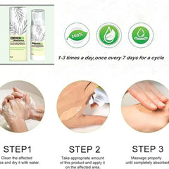 Anti Fungal Spray (Buy 1 Get 1 Free)
